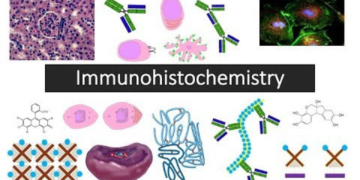 Immunohistochemistry Market Promising Growth and by Platform Type, Technology and End User Industry Statistics, Scope, D