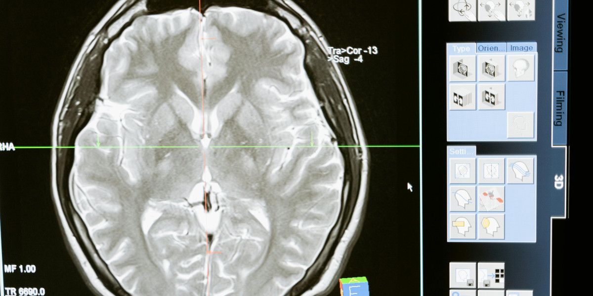 Neurological Disease Models: A Crucial Tool for Understanding Brain Disorders