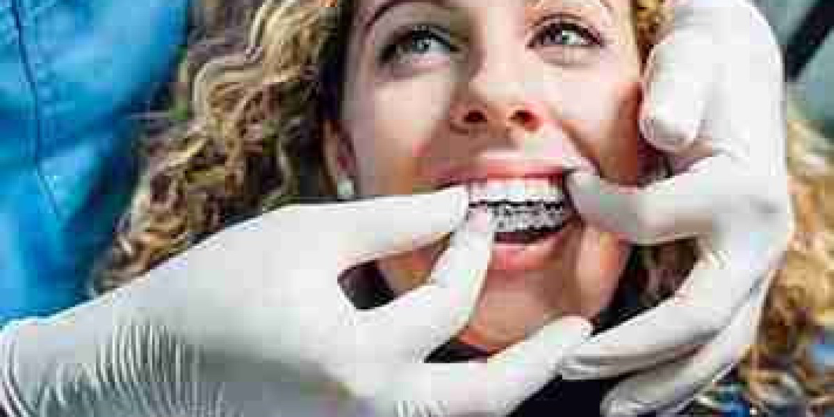 Enhance your smile subtly using Invisalign aligners