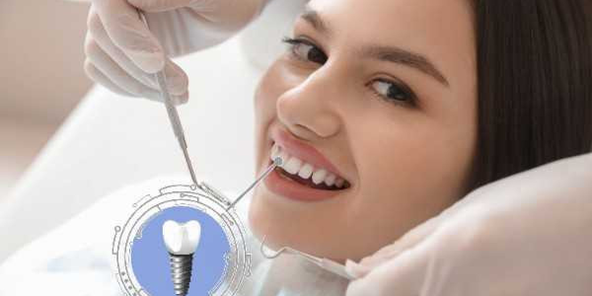 Learn How Long the Results of Teeth Whitening Last
