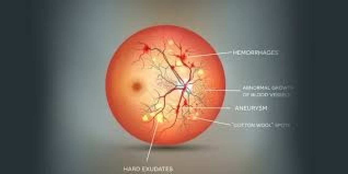 Retinal Disease Management Market Outlook (2025–2034): Opportunities and Insights