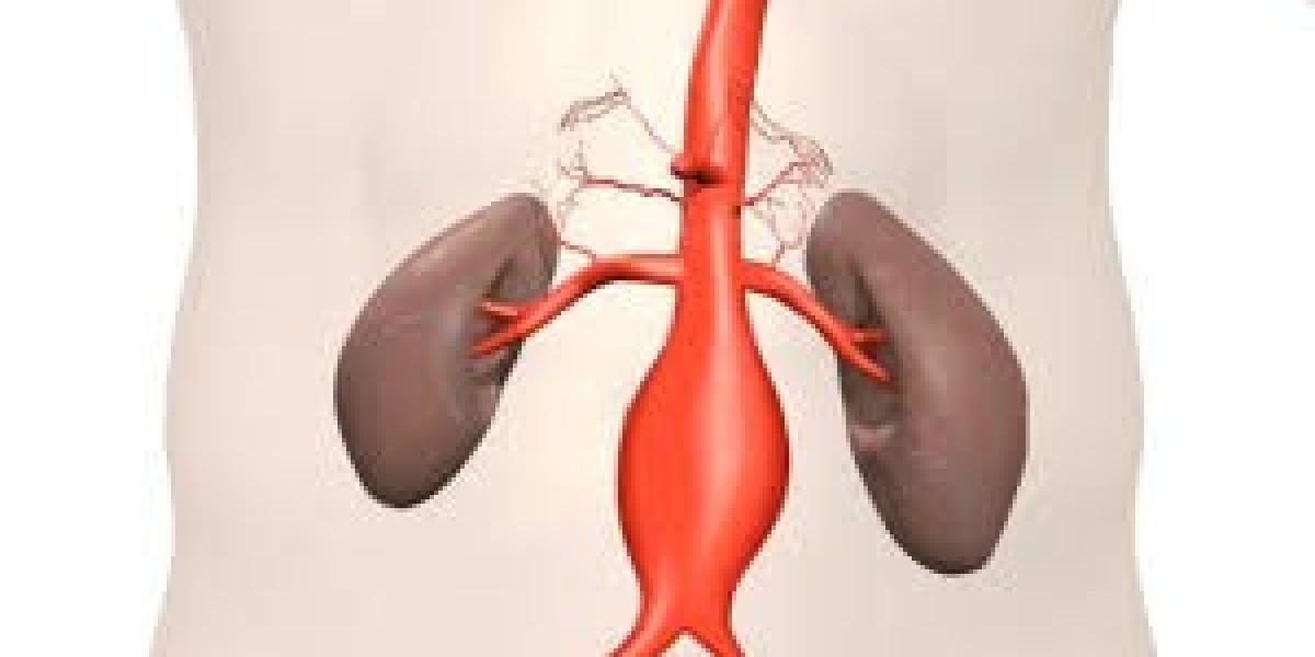 Endovascular Aneurysm Repair Market Outlook (2025–2034): Opportunities and Insights