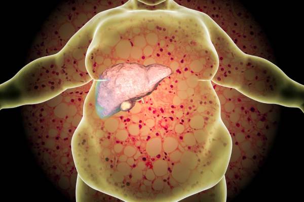Fatty Liver Disease Treatment in Bangalore | Liver Specialist - Dr Bhushan Chittawadagi