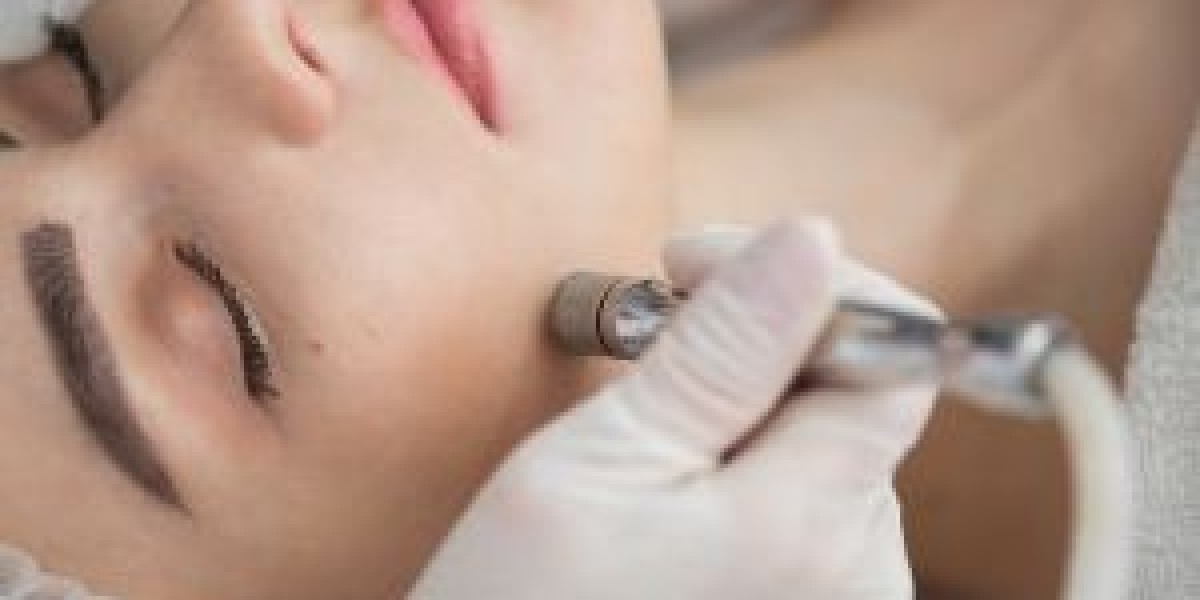 Microdermabrasion in Hyattsville, MD | Spa Chevy Chase