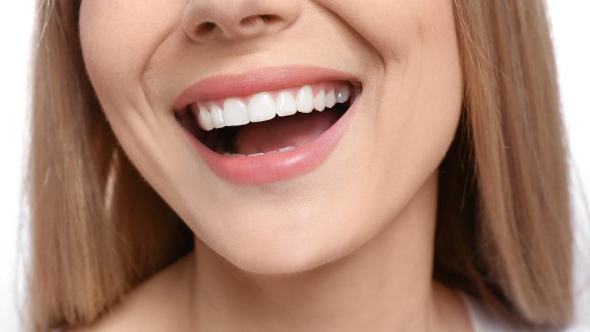 Can a Smile Makeover Look Natural? What Creates a Subtle Cosmetic Result